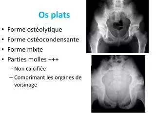 os plats