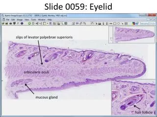 Slide 0059: Eyelid