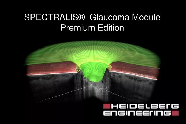 spectralis glaucoma module premium edition