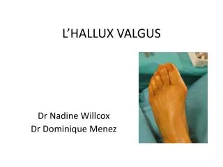 l hallux valgus