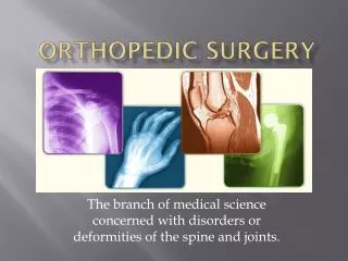 Orthopedic Surgery