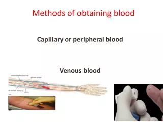 Methods of obtaining blood