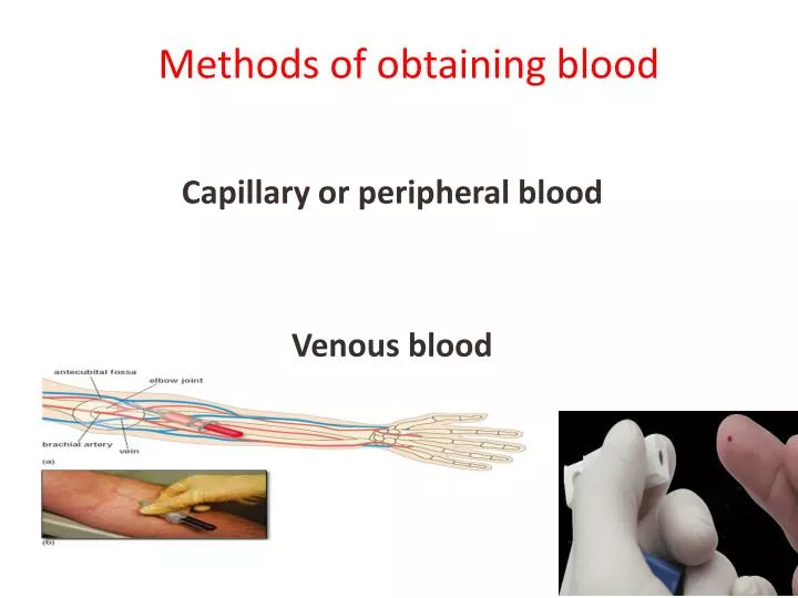 methods of obtaining blood