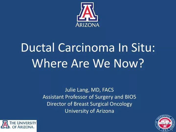ductal carcinoma in situ where are we now