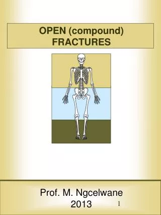 OPEN (compound) FRACTURES Prof. M. Ngcelwane 2013