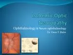 Ischemic Optic Neuropathy - slide 1