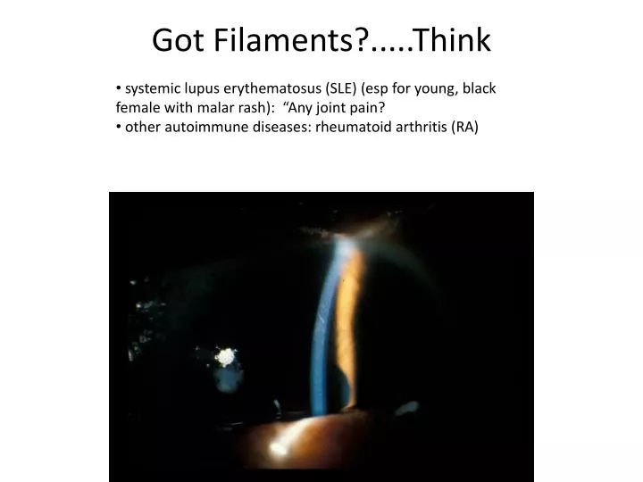 got filaments think