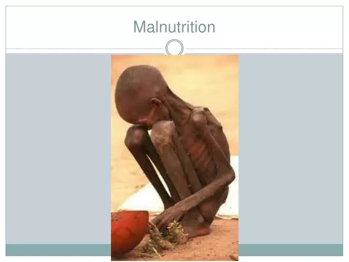 malnutrition