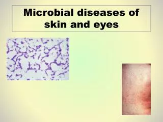 Microbial diseases of skin and eyes