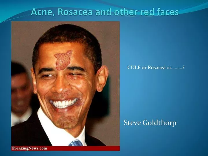 acne rosacea and other red faces