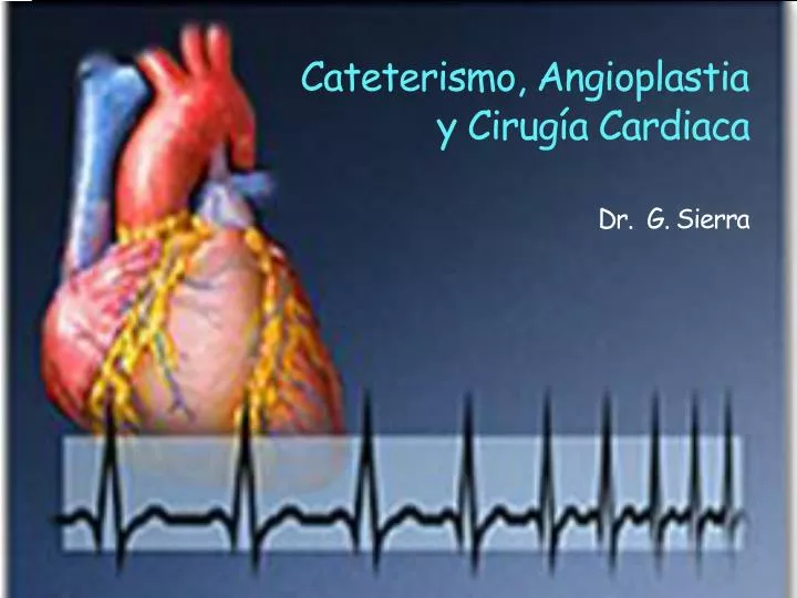 cateterismo angioplastia y cirug a cardiaca dr g sierra