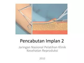 pencabutan implan 2