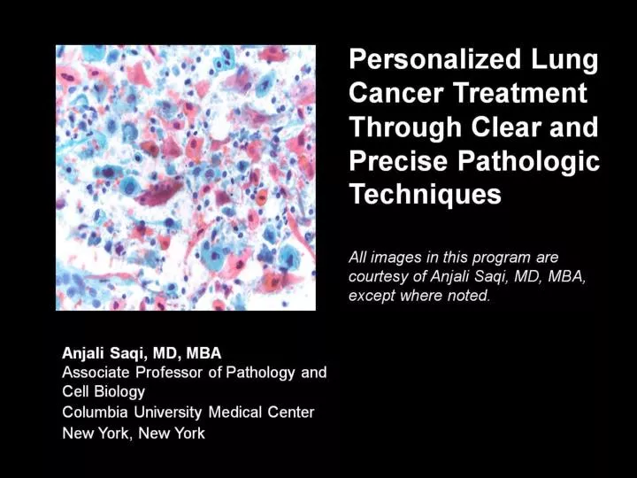 personalized lung cancer treatment through clear and precise pathologic techniques