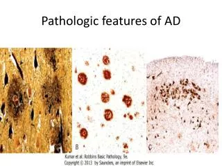 Pathologic features of AD