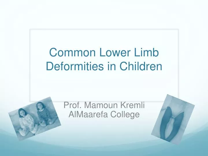 common lower limb deformities in children