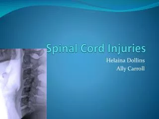 Spinal Cord Injuries