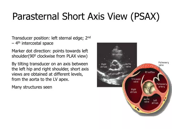 parasternal short axis view psax