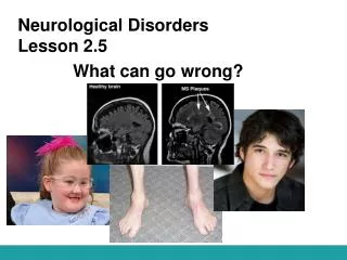 Neurological Disorders Lesson 2.5