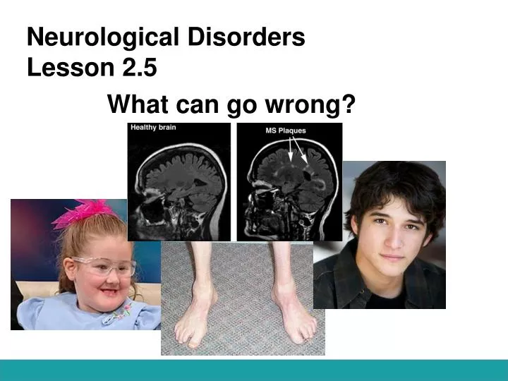 neurological disorders lesson 2 5