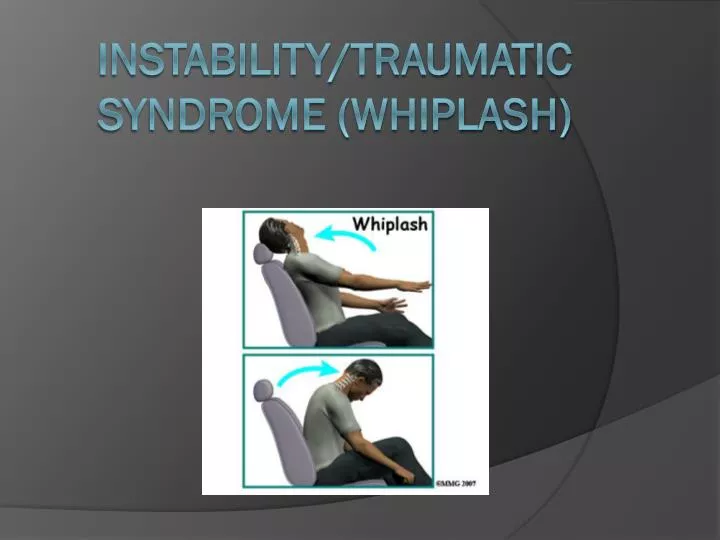 instability traumatic syndrome whiplash