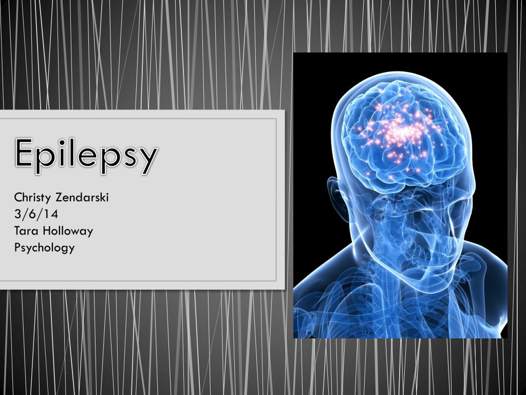 PPT - Epilepsy PowerPoint Presentation, free download - ID:1947938