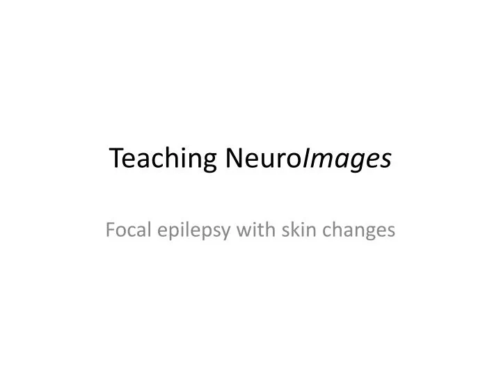 teaching neuro images
