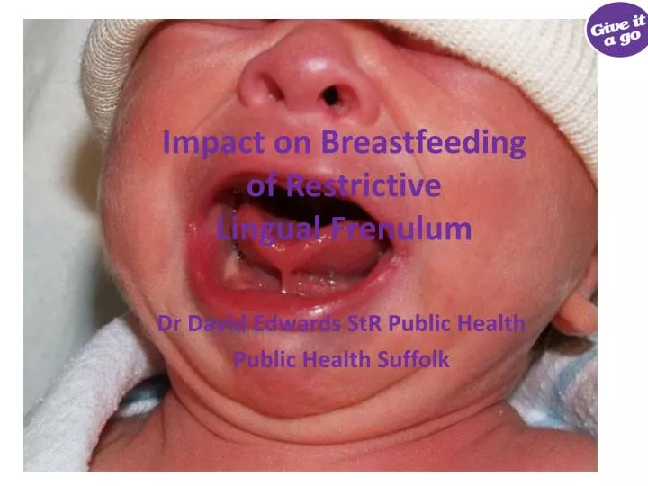 impact on breastfeeding of restrictive lingual frenulum