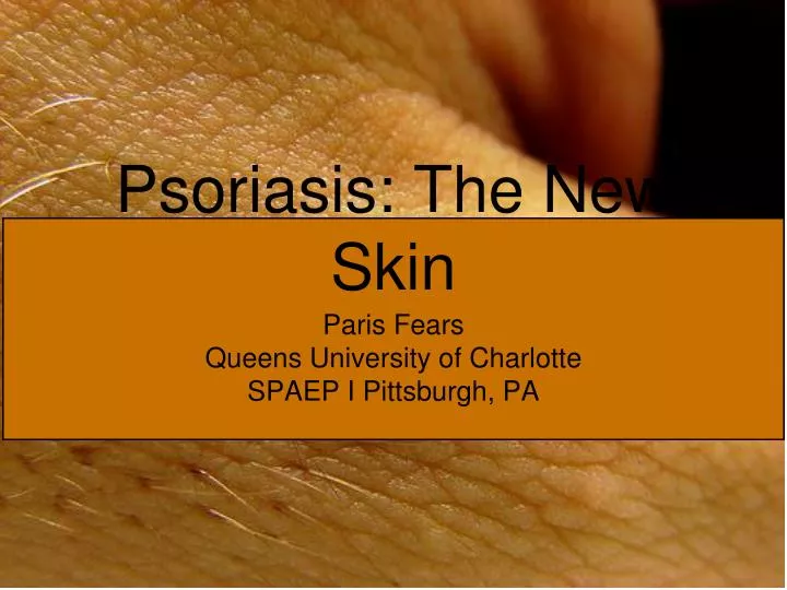 psoriasis the new skin