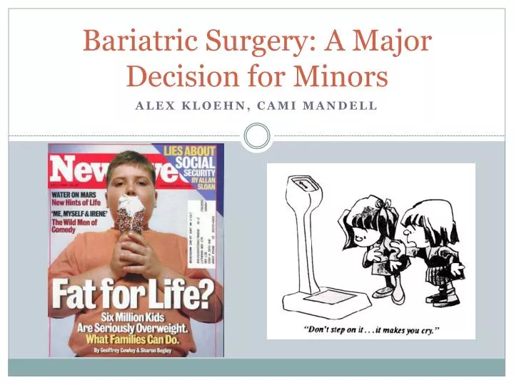 bariatric surgery a major decision for minors