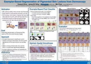 Exemplar-Based Segmentation of Pigmented Skin Lesions from Dermoscopy Images
