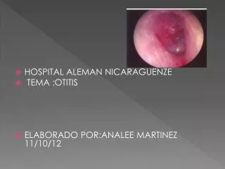 HOSPITAL ALEMAN NICARAGUENZE TEMA :OTITIS ELABORADO POR:ANALEE MARTINEZ 11/10/12