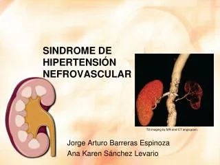 sindrome de hipertensi n nefrovascular