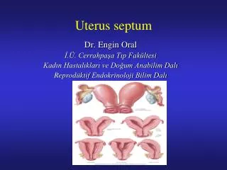 Uterus septum