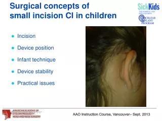 Surgical concepts of small incision CI in children