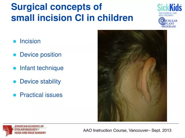 surgical concepts of small incision ci in children