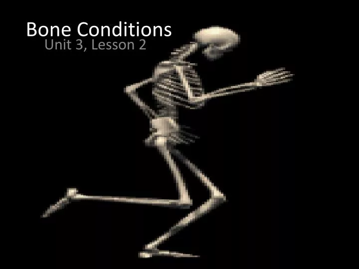 bone conditions