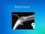 Bone Cancer - slide 1
