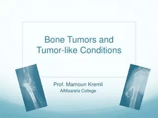 Bone Tumors and Tumor-like Conditions