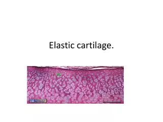 Elastic cartilage.