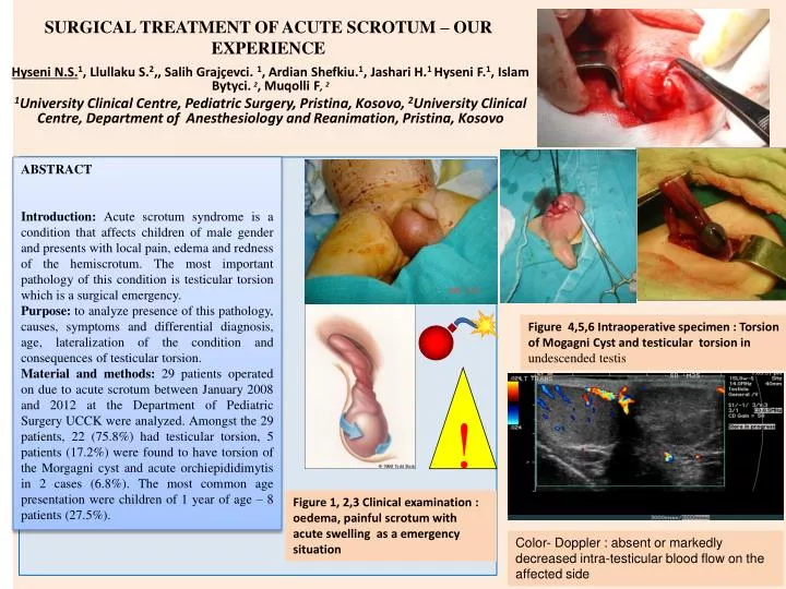 surgical treatment of acute scrotum our experience