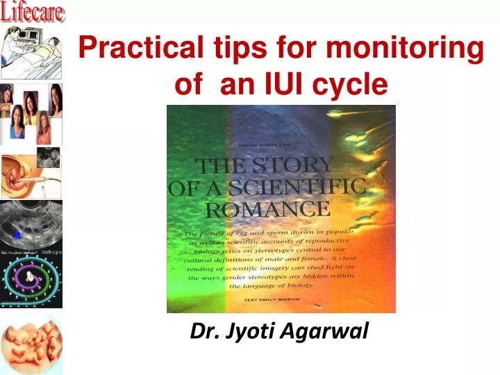 practical tips for monitoring of an iui cycle