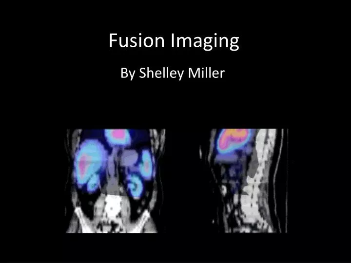 fusion imaging