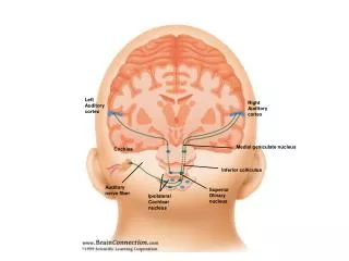 Left Auditory cortex