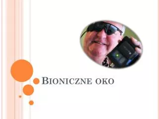 bioniczne oko