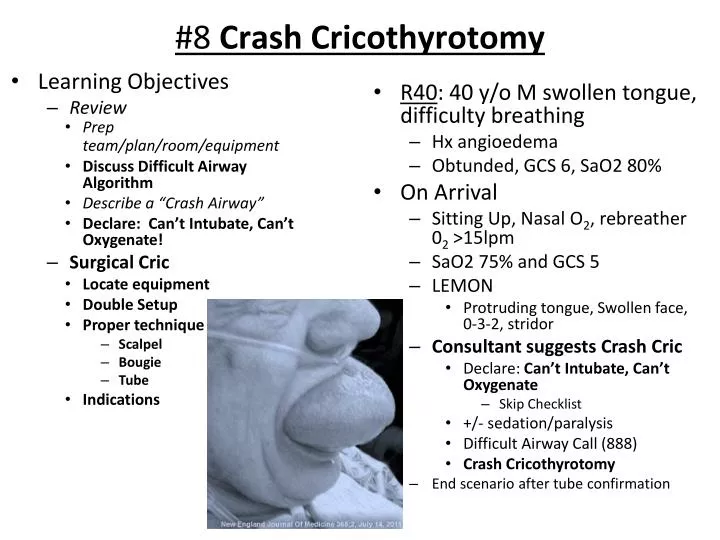 8 crash cricothyrotomy