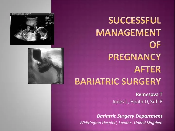 successful management of pregnancy after bariatric surgery