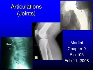 Articulations (Joints)