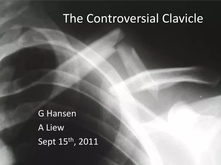 the controversial clavicle