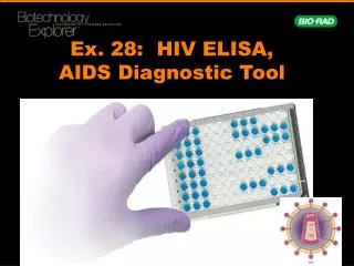 Ex. 28: HIV ELISA, AIDS Diagnostic Tool