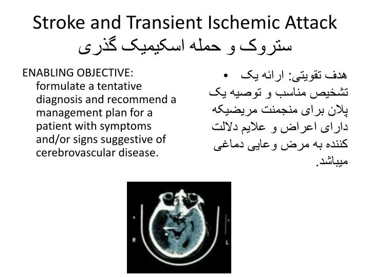 stroke and transient ischemic attack
